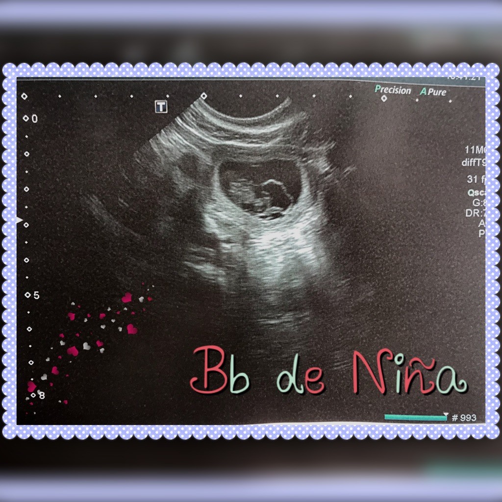 Des Guerriers De Narbonne - Confirmation de gestation